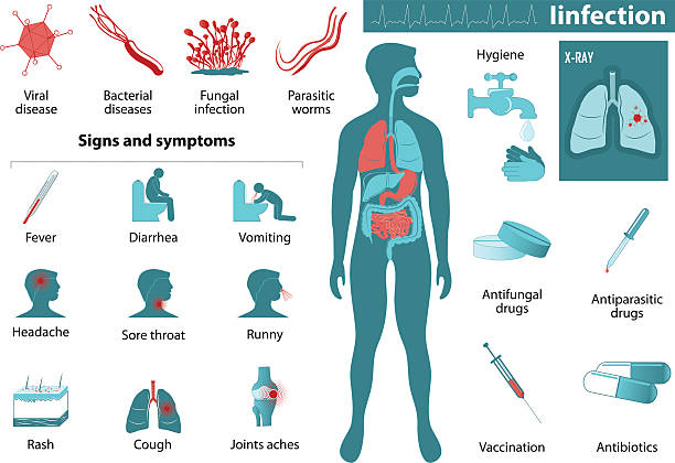 Understanding Inomyalgia: Symptoms, Causes, and Management