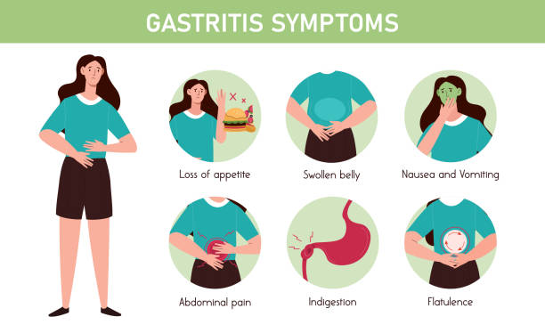 Gastroshiza: Understanding a Rare Digestive Condition